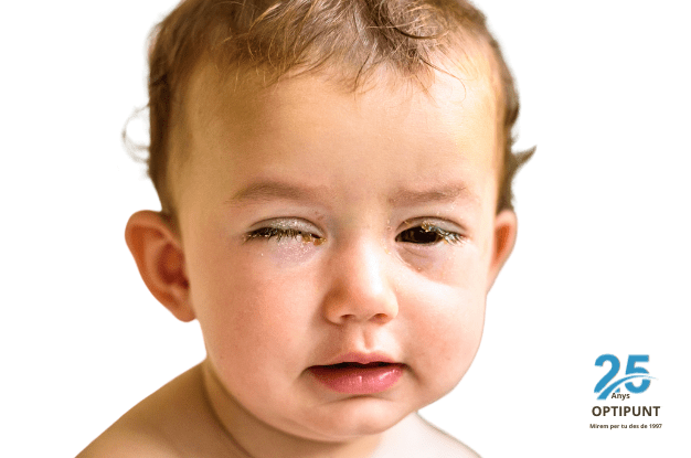 Qué hago si mi bebé de 6 meses tiene mucha tos?