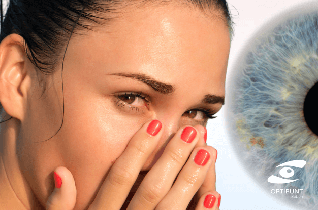Mujer con ardor en los ojos por irritación ocular – Optipunt Dr. Zaben Figueres