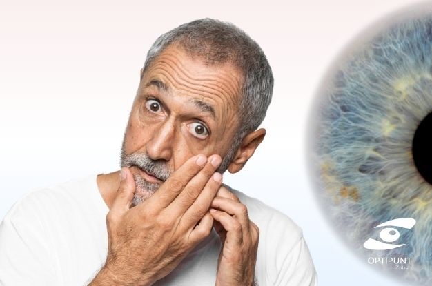 Foto de portada de persona con ojo seco