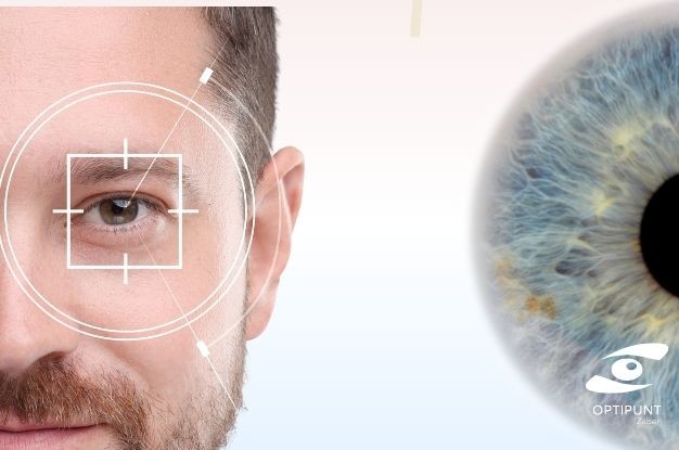 Orto-K y miopía: beneficios, limitaciones y seguimiento profesional.