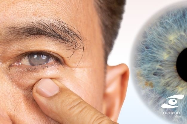 Glaucoma explicado de forma clara. Señales, revisiones y control visual.