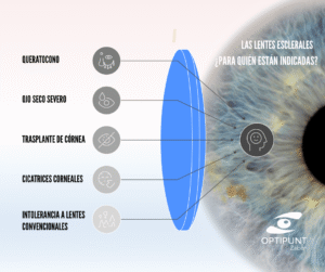 Indicaciones de las lentes esclerales en queratocono, ojo seco severo, trasplante de córnea y cicatrices corneales